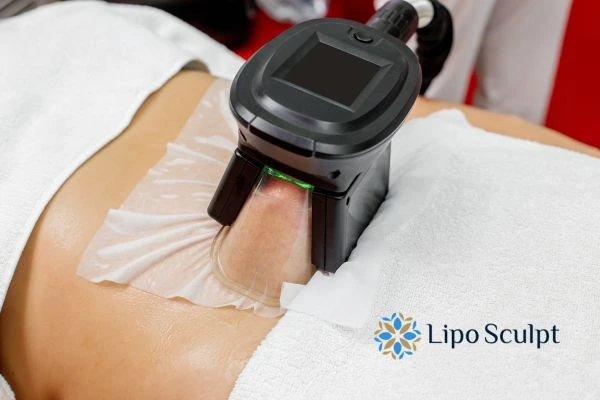 Does Fat Freezing at Home Work? DIY Devices vs Professional Cryolipolysis 1 How is professional cryolipolysis different Kings Norton?