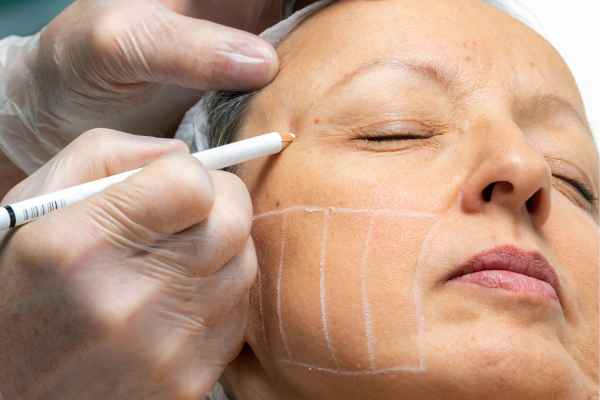 CryoPen: 5 Skin Concerns It May Be Used to Treat 4 What should you ask before having CryoPen treatment Kings Norton?