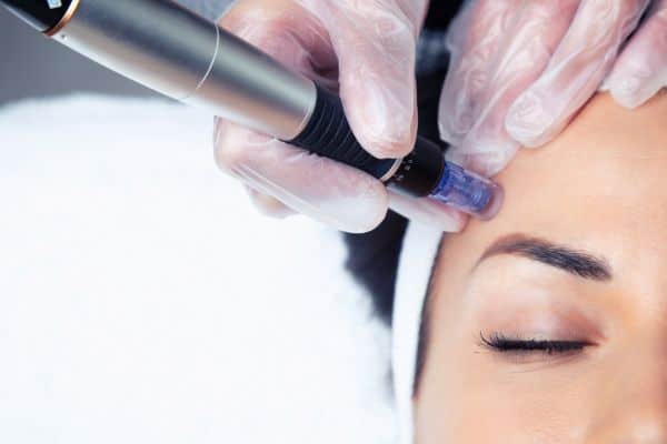Explaining Total Skin Tightening Treatment and What to Expect 2 What Skin Concerns Can Total Skin Tightening Treatment Help With Kings Norton?